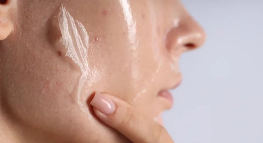 Cilt Kuruluğu Neden Olur, Nasıl Geçer? - RHANEVA